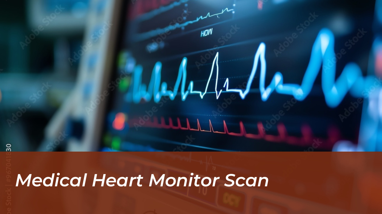 Inquest Rules Flight Turbulence Caused Fatal Cardiac Arrest 6 Medical Heart Monitor Scan